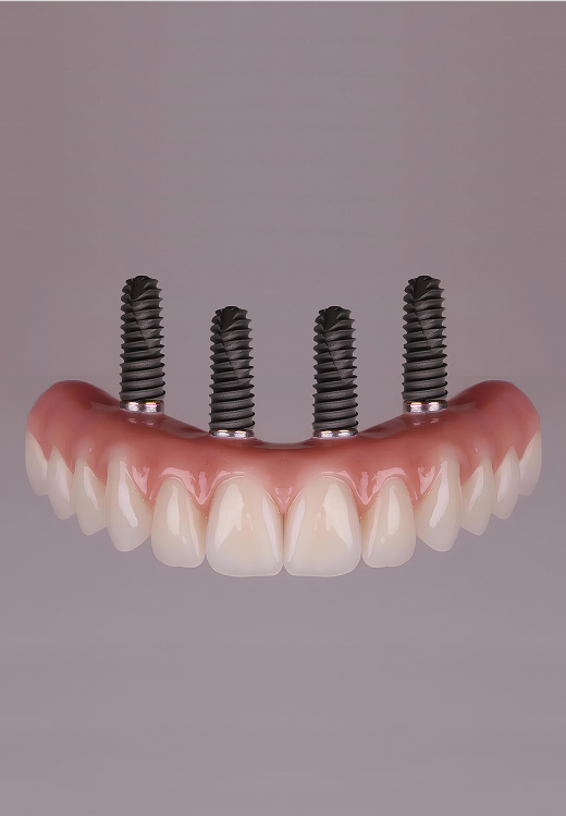 All-on-4 and Full Arch Banner