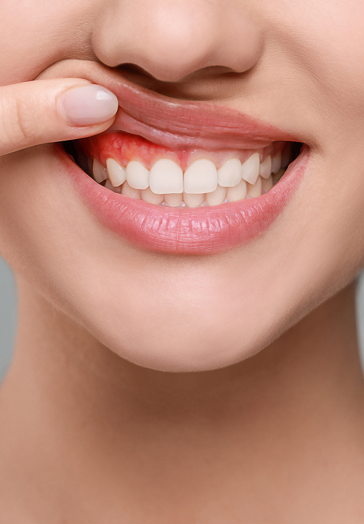 Gum Disease Treatment Banner