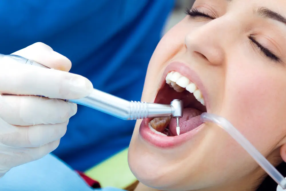 Dental Bonding